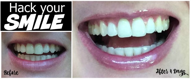 Beauty hacks to make your teeth whiter